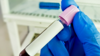 hand with blue latex glove holding vial of blood